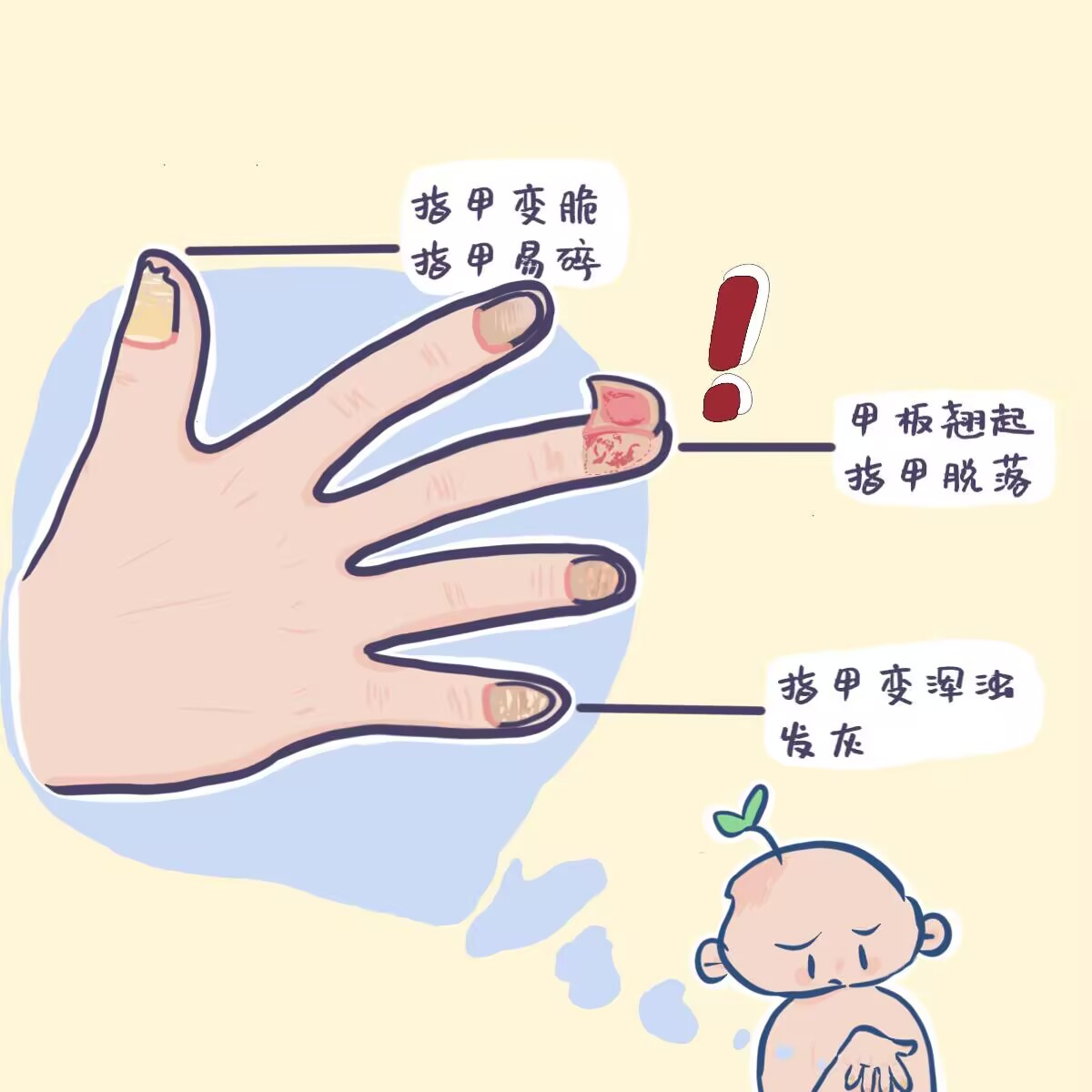 依心医意｜指尖之舞 读懂指甲的健康语言-湖南师范大学医学部