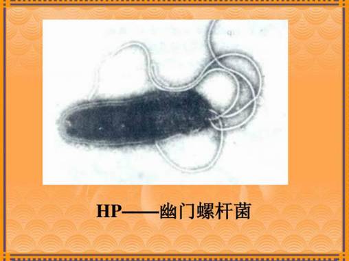 幽门螺旋 幽门螺旋